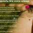Что делать если обнаружили на себе клеща?. - Администрация г. Клинцы