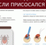 За неделю в Ульяновске клещи присосались к 48 людям - Ульяновск сегодня