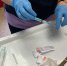 У пациента, которому ввели новую российскую вакцину от рака, наблюдают улучшения - Gubdaily.Ru