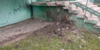 В Шебекино мужчина пострадал от найденного на своём участке неизвестного предмета - БелПресса