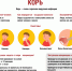 Профилактика кори в трудовых коллективах - Роспотребнадзор