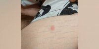 В Воронеже мужчина выстрелил из страйкбольного пистолета в 11-летнего мальчика - РИА Воронеж