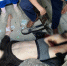 Как живет подросток из Петрозаводска, потерявший ногу из-за удара током - Gubdaily.Ru