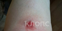 Смерть в последний день весны и травмы из-за разбитой плитки в Калининграде: 8 событий, которые обсуждали в выходные   - Новости Калининграда | Фото: Елена - Klops.Ru