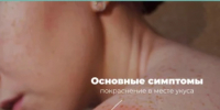 Клещевой боррелиоз (болезнь Лайма): прививки нет! Как уберечь себя и близких? - Балтачевский район