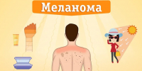 Профилактика меланомы - Варнавинский муниципальный округ
