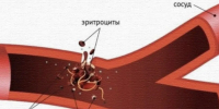 Брянские трансфузиологи создали лиофилизированные тромбоциты - Брянская улица