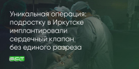 Поделитья во ВКонтакте - Братская Студия Телевидения