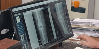 Челябинские врачи установили женщине протез, созданный на 3D-принтере - Агентство новостей Доступ