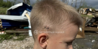 Пострадавший от смерча в Кушве шестилетний мальчик рассказал, как все было - Четвертый канал