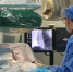 Горбольницу Пятигорска оснастили новой рентген-системой - Министерство Здравоохранения