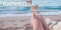 Псковская областная клиническая больница предлагает радиочастотную абляцию для лечения варикоза - Pln-Pskov.Ru