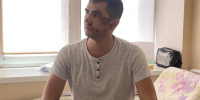 Специалисты горбольницы скорой медицинской помощи Ставрополя напомнили о необходимости соблюдения правил эксплуатации электросамокатов - Министерство Здравоохранения