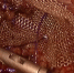 Медицинский прорыв в Новосергиевке: впервые проведена лапароскопия пупочной грыжи - Ria56.Ru