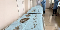 Приморские врачи рассказали, какие предметы чаще всего проглатывают дети - Администрация Приморского края