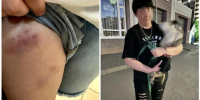 В Ростове обезьяна напала на 10-летнего ребёнка на улице Зорге - Bloknot-Rostov.Ru
