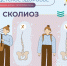Сколиоз: как распознать и предотвратить опасное искривление позвоночника - КБ №8 ФМБА России