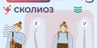 Сколиоз: как распознать и предотвратить опасное искривление позвоночника - КБ №8 ФМБА России