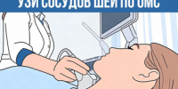 УЗИ СОСУДОВ ШЕИ ПО ОМС - ТФОМС