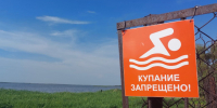Главный дерматолог Челябинской области объяснил причину сыпи после озёр - Pchela.News