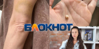 «Приехала домой, а попала в ад»: бывший муж душил и избил ростовчанку прямо в фитнес-клубе - Bloknot-Rostov.Ru