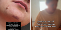 Женщина напала на новосибирскую зоозащитницу после изъятия 60 кошек - Gorsite.Ru