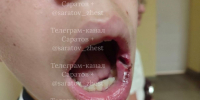 «Применял ноги, кулаки, угрожал»: в Энгельсе мужчину ищут за избиение подростка - ИА Версия-Саратов