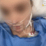 20-летняя Маша из Приморья подхватила страшную заразу в Сингапуре - ГТРК Владивосток