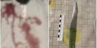 Пьяная астраханка ударила соседа ножом и оставила умирать на балконе - Bloknot-Astrakhan.Ru
