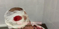 Трое неизвестных напали на мужчину на пешеходном переходе в Самарской области - Самарская Газета