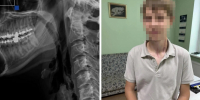 Челябинские врачи спасли подростка-мотоциклиста, которому рассекло шею проволокой до позвоночника - Pchela.News