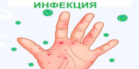 Профилактика энтеровирусной инфекции. - Нижнеингашский район