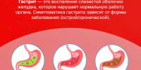 _W3cFge2vXVZv_096PxS6g9QFhnIIJXTEkrA2QbJtrylYJ02pgMRgeJNOkYrYFPHGPjRJgSLa5jGRAxrsxjdhPBr.jpg - Чебоксарская РБ