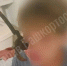 В Башкирии спасли зрение подростка, которому в лицо попал садовый секатор - ProUral.Info