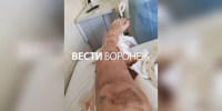 Завод в Лисках оштрафовали на 305 тысяч после ЧП с лишившимся ноги рабочим - ГТРК Воронеж