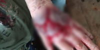 Фото: соц.сети | Вдова участника войны попала в больницу после конфликта из-за дома в Приморье - PrimPress.Ru