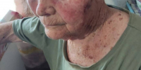 В Приморье возбуждено уголовное дело после избиения пенсионерки падчерицей - ГТРК Владивосток