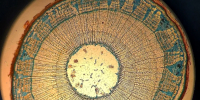 Поперечный срез стебля липы (Tilia cordata). Окраска сафранином и анилиновым синим. Увеличение: 40x. Именно он принес Дарье победу. - Калужский перекрёсток