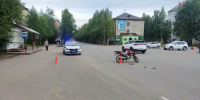 15-летний водитель питбайка и его 13-летняя пассажирка пострадали в ДТП в Печоре - ИА Комиинформ