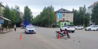 В Печоре подросток на питбайке получил закрытый перелом - Bnkomi.Ru