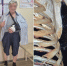 Балаковец едва не потерял руку из-за обмана. Его конечность спасли врачи - ИА Взгляд-инфо