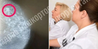 Никаких жалоб не было, но в груди образовался рак: уфимку вовремя спасли благодаря плановому обследованию - Комсомольская правда