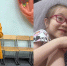 Родители — носители гена: девочка из Новосибирска живёт с неизлечимым заболеванием глаз - Gorsite.Ru