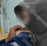 Происшествие в лагере: 12-летняя девочка защемила губу собачкой от молнии - Gorod48.ru