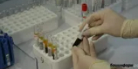 В Уфу туристы завезли лихорадку денге - Башинформ