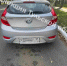 «Hyundai Solaris» сбил 9-летнюю девочку на улице Кирова в Туле - ИА Тульские новости