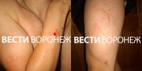 Велосипедист пожаловался на напавшего на него воронежца в парке «Танаис» - ГТРК Воронеж