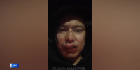 Уфимец упал в выбоину на пересечении улиц Мубарякова и Софьи Перовской и сломал четыре зуба | ГТРК «Башкортостан» - ГТРК Башкортостан