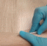 Ярославская область на 18 месте в России по эпидемиологической ситуации по туберкулезу - Министерство здравоохранения