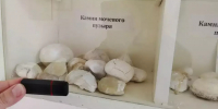 Свердловские врачи удаляют камни в почках за 30 минут без разрезов с помощью нового российского лазера - ОТВ
